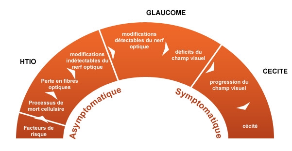 glaucome-11